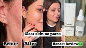 Buy 1 Get 1 Free, Ordinary Niacinamide 10% + Zinc 1% & Free Face Wash