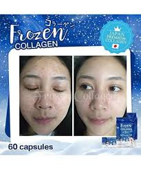 2 Pack DEAL Frozen Collagen + 2 in 1 Whitening