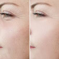 2 Pack DEAL Frozen Collagen + 2 in 1 Whitening